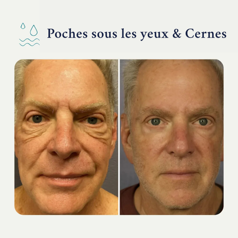 Pack Forge au suif de bœuf– Spécialement pour la peau des hommes matures