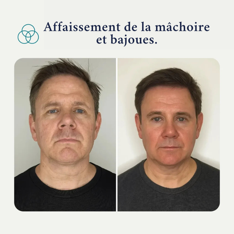 Pack Forge au suif de bœuf– Spécialement pour la peau des hommes matures