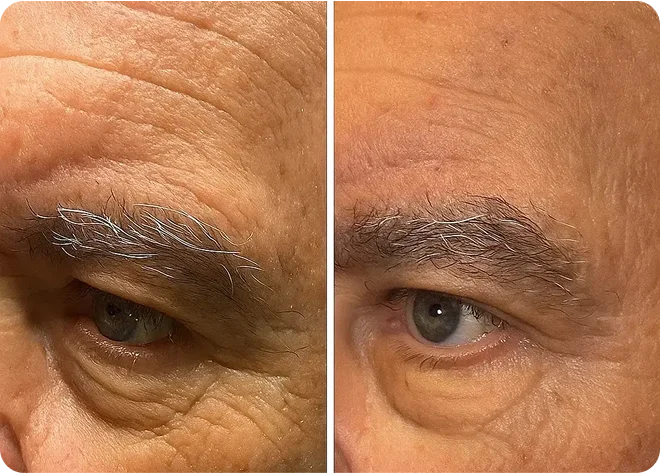 Pack Forge au suif de bœuf– Spécialement pour la peau des hommes matures